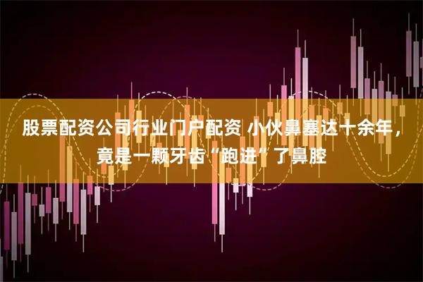 股票配资公司行业门户配资 小伙鼻塞达十余年，竟是一颗牙齿“跑进”了鼻腔